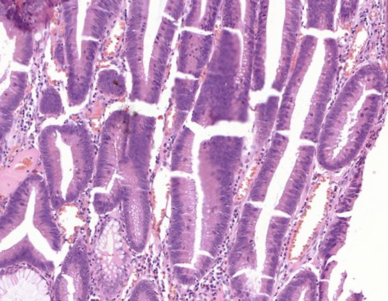 Histopathologisches Bild: Kolonschleimhaut